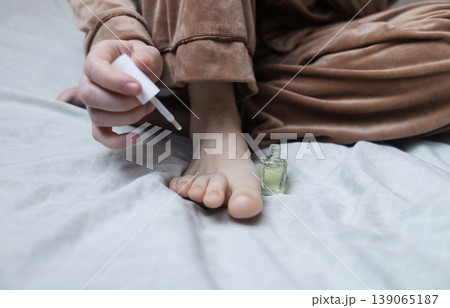 A woman in pajamas sitting on a bed and applying antifungal nail polish to treat onychomycosis. Home treatment of fungal infection, yellow nails, and medical pedicure for healthy feet. A woman in pajamas sitting on a bed and applying antifungal nail polish to treat onychomycosis. Home treatment of fungal infection, yellow nails, and medical pedicure for healthy feet. 139065187