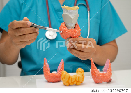 Hyperthyroidism, Overactive Thyroid, Thyroid Lymphoma, Asian doctor with thyroid gland human model in hospital. 139090707