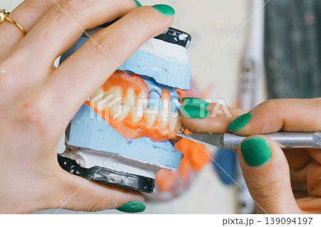 Meticulous craft of a dental technician shaping dentures in the workshop Meticulous craft of a dental technician shaping dentures in the workshop 139094197