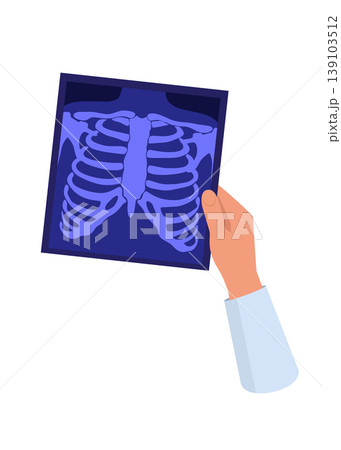 Hand Holding a Chest Xray Film Showing Rib Cage and Spine Hand Holding a Chest Xray Film Showing Rib Cage and Spine 139103512