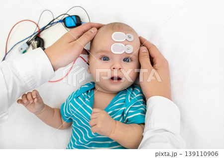 Newborn hearing screening and diagnosis at the hospital. Baby having hearing screening with special electrodes on his head and ear Newborn hearing screening and diagnosis at the hospital. Baby having hearing screening with special electrodes on his head and ear 139110906