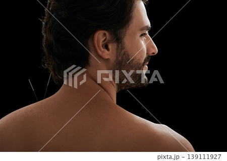 Close-up view from male patient back with acupuncture needles in his shoulder with pain, over black background. Acupuncture, reflexology Close-up view from male patient back with acupuncture needles in his shoulder with pain, over black background. Acupuncture, reflexology 139111927