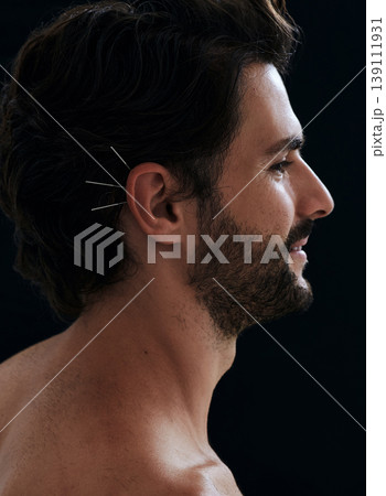 Handsome man having ear acupuncture for diseases treatment, over black background, side view. Acupuncture, reflexology, traditional Chinese medicine 139111931