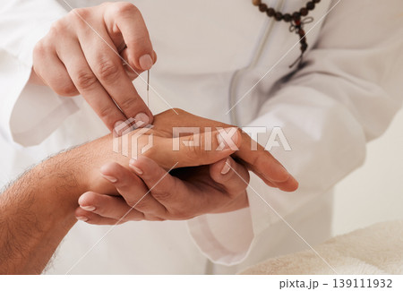 Reflexologist insert acupuncture needle into a patient's wrist hand. Acupuncture treatment, reflexology, alternative medicine 139111932