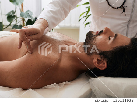 Acupuncturist doing puncture on active foot point on meridian system human body, chinese traditional medicine. Acupuncture, reflexology Acupuncturist doing puncture on active foot point on meridian system human body, chinese traditional medicine. Acupuncture, reflexology 139111938