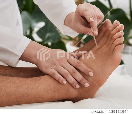 Acupuncture treatment for chronic foot pain. Chiropractor doing acupuncture therapy for patient feet with needles. Reflexology Acupuncture treatment for chronic foot pain. Chiropractor doing acupuncture therapy for patient feet with needles. Reflexology 139111944