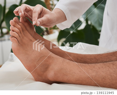 Reflexologist doing acupuncture therapy for patient feet with needles. Acupuncture, reflexology, acupuncture treatment for chronic foot pain Reflexologist doing acupuncture therapy for patient feet with needles. Acupuncture, reflexology, acupuncture treatment for chronic foot pain 139111945