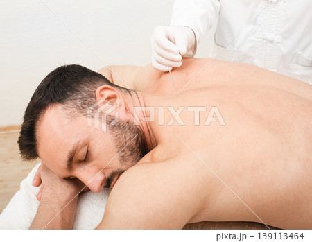 Man enjoys the acupuncture procedure. acupuncturist doing acupuncture very accurately. Needle close up 139113464
