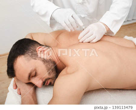 Acupuncturist inserting a needle into a male back. Patient having traditional Chinese treatment using needles to restore an energy flow through specific points on the skin. Acupuncturist inserting a needle into a male back. Patient having traditional Chinese treatment using needles to restore an energy flow through specific points on the skin. 139113479
