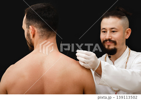 Reflexologist hand with acupuncture needle near the shoulder man. Treatment of a man body with Chinese medicine methods. Needles on a black background close-up 139113502