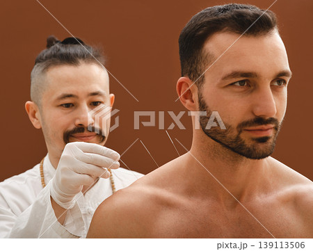 Acupuncturist inserts acupuncture needle into a man shoulder that cures him of an illness. Acupuncture treatment of diseases. 139113506