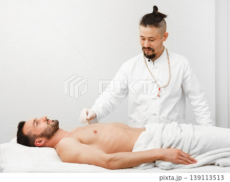 Acupuncturist inserts acupuncture needles at special points on the meridians of a man body. Alternative medicine, needle treatment Acupuncturist inserts acupuncture needles at special points on the meridians of a man body. Alternative medicine, needle treatment 139113513
