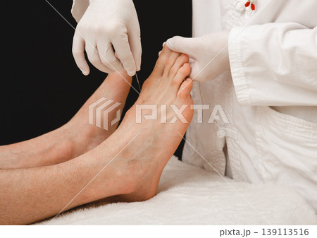 Acupuncture of human foot. Acupuncture needles close up. Acupuncture treatment for chronic pain Acupuncture of human foot. Acupuncture needles close up. Acupuncture treatment for chronic pain 139113516