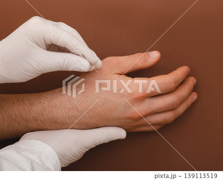 Acupuncturis insert an acupuncture needle into the patient's hand. Acupuncture treatment for many diseases. Close up on a brown background Acupuncturis insert an acupuncture needle into the patient's hand. Acupuncture treatment for many diseases. Close up on a brown background 139113519