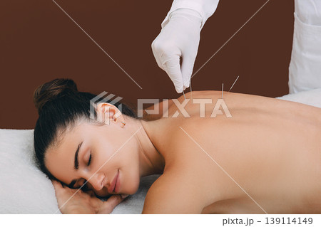 Woman enjoys the acupuncture procedure. An acupuncturist doing acupuncture very accurately. Needle close up Woman enjoys the acupuncture procedure. An acupuncturist doing acupuncture very accurately. Needle close up 139114149