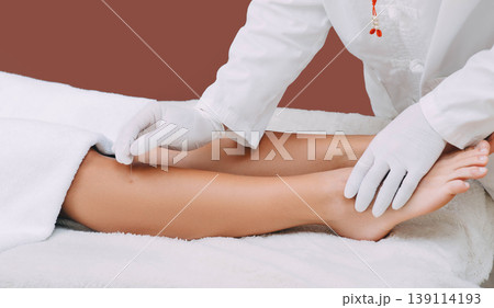 Reflexologist doing acupuncture to the patient. Needle therapy helps patients get rid of many diseases. Alternative medicine Reflexologist doing acupuncture to the patient. Needle therapy helps patients get rid of many diseases. Alternative medicine 139114193