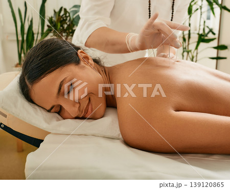 Alternative medicine, reflexology. Treatment of back pain with acupuncture needles for female patient. Traditional Chinese Medicine 139120865