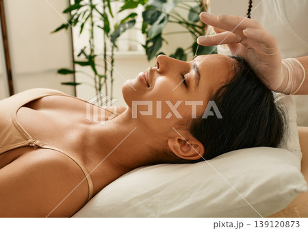 Reflexologist inserts acupuncture needles into acupuncture point on female head for headaches treatment. Traditional chinese medicine, reflexology 139120873