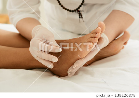 Chiropractor doing acupuncture therapy for female feet with needles. Acupuncture treatment for chronic foot pain 139120879