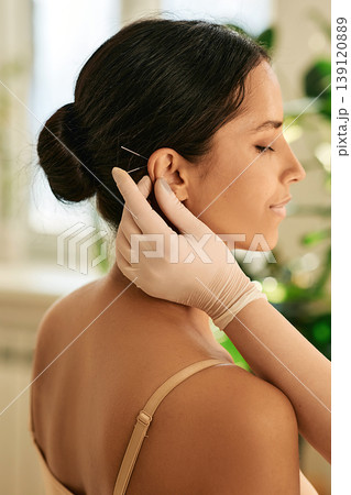 Acupuncture. Woman having ear acupressure or ear acupuncture , side view 139120889