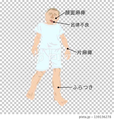 Illustrations of early stroke symptoms | Facial paralysis, slurred speech, hemiplegia, dizziness | Signs of abnormalities in the elderly 139136278