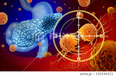 Pancreatic Cancer Treatment 139148151