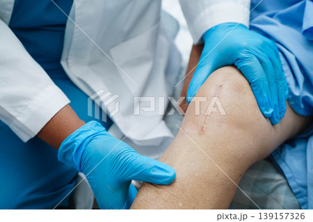 Doctor checking Asian elderly woman patient with scar knee replacement surgery in hospital. 139157326