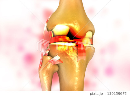 knee joint arthritis on abstract background 139159675