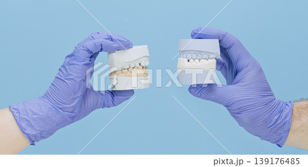 Orthodontics concept banner: Dentist hands holding two plaster dental jaw models for bite comparison. Orthodontics concept banner: Dentist hands holding two plaster dental jaw models for bite comparison. 139176485