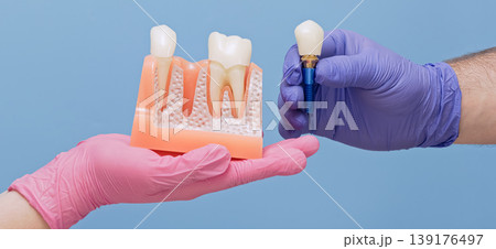 Dentist holding a complete titanium dental implant with crown near jaw model with missing tooth. Wide dentistry banner with copy space. Dentist holding a complete titanium dental implant with crown near jaw model with missing tooth. Wide dentistry banner with copy space. 139176497