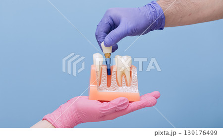 Dentist hand inserting a complete titanium dental implant into an empty bone socket of a jaw model. Implantology surgery concept. Dentist hand inserting a complete titanium dental implant into an empty bone socket of a jaw model. Implantology surgery concept. 139176499