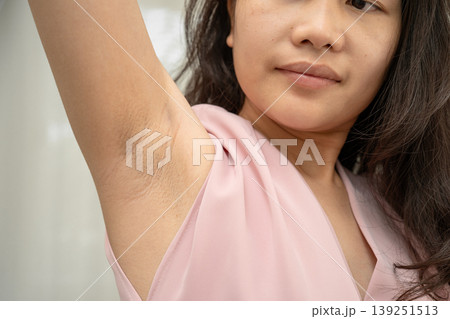 Asian woman have problem black armpit beauty skin care. Asian woman have problem black armpit beauty skin care. 139251513