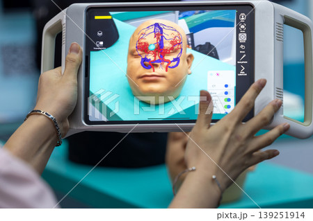 Surgeon using advanced Augmented Reality surgical navigation system on tablet visualize 3D scan, Augmented Reality AR technology in neurosurgery visualization digital. Surgeon using advanced Augmented Reality surgical navigation system on tablet visualize 3D scan, Augmented Reality AR technology in neurosurgery visualization digital. 139251914