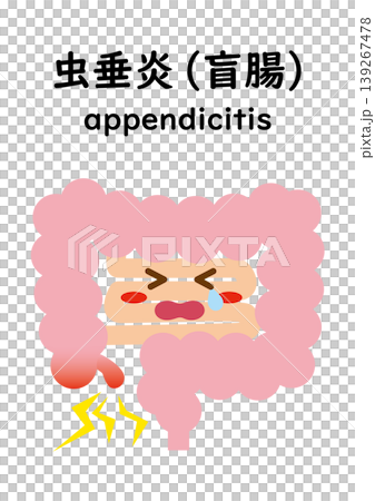 大腸闌尾炎(角色) 大腸闌尾炎(角色) 139267478