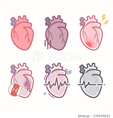 Medical illustration of human heart conditions including healthy, heart attack, arrhythmia and failure Medical illustration of human heart conditions including healthy, heart attack, arrhythmia and failure 139293622