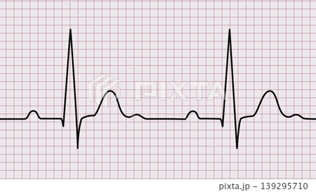 Black heart beat line on medical paper grid. Black heart beat line representing an EKG or ECG reading displayed on a red medical paper grid, symbolizing health and medicine. Black heart beat line on medical paper grid. Black heart beat line representing an EKG or ECG reading displayed on a red medical paper grid, symbolizing health and medicine. 139295710