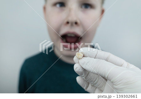10 year old boy at pediatric dentist showing milk tooth extraction. Concept of caries treatment, physiological change of teeth and permanent teeth eruption in school age children. 139302661