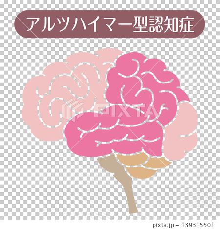 アルツハイマー型認知症 脳イラスト 線なし 139315501