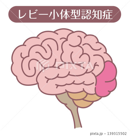 レビー小体型認知症 脳イラスト 線あり レビー小体型認知症 脳イラスト 線あり 139315502