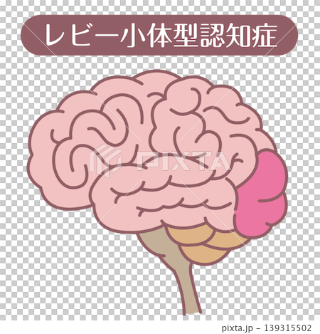レビー小体型認知症 脳イラスト 線あり レビー小体型認知症 脳イラスト 線あり 139315502