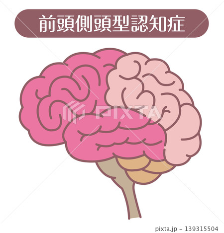 前頭側頭型認知症 脳イラスト 線あり 前頭側頭型認知症 脳イラスト 線あり 139315504