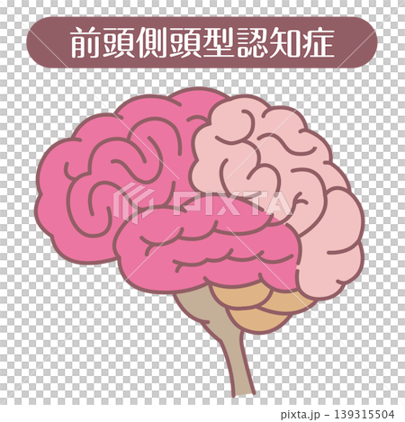 前頭側頭型認知症 脳イラスト 線あり 前頭側頭型認知症 脳イラスト 線あり 139315504