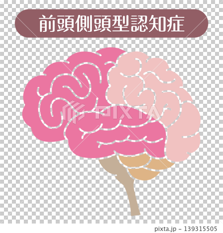 前頭側頭型認知症 脳イラスト 線なし 139315505