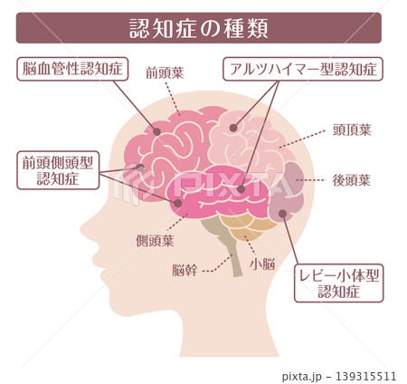 認知症の種類 横顔脳イラスト 線なし 139315511