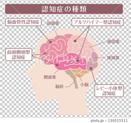 認知症の種類 横顔脳イラスト 線なし 139315511