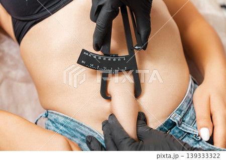 Liposuction. Doctor of aesthetic cosmetology measures the fat sediments on the client's stomach with a caliper. Close up. Top view. Professional cosmetology in a beauty salon 139333322