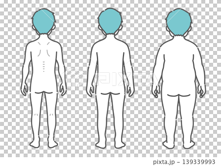 男孩體型對比圖（瘦弱、中等、肥胖 - 背面視角） 139339993