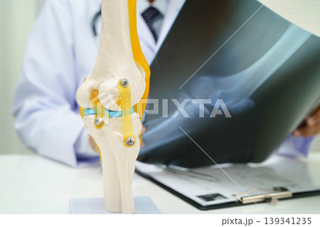 Doctor examining knee joint bone radiography xray film. 139341235