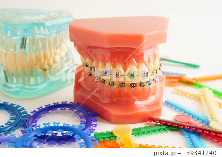 Orthodontic ligatures rings and ties, elastic rubber bands on orthodontic braces, model for dentist studying about dentistry. 139341240