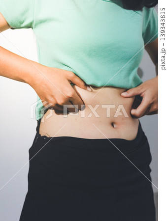 Flabby belly after pregnancy, overweight female body on gray background 139343815